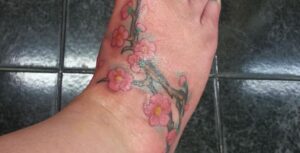 Hoe voet-, been- of enkelzwelling na een tatoeage te behandelen